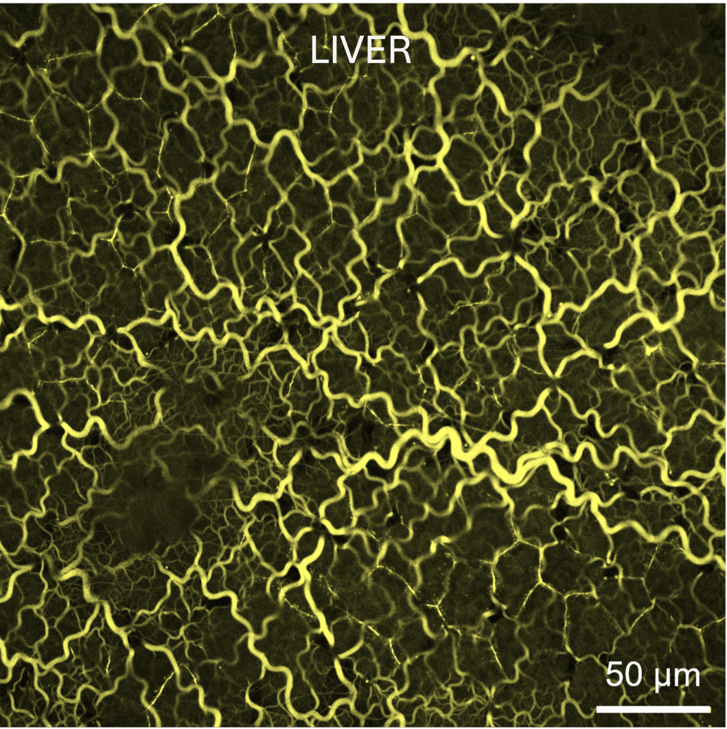 Use of Rhobo6 ECM Dye for labeling the extracellular matrix (ECM) in liver kidney tissues.